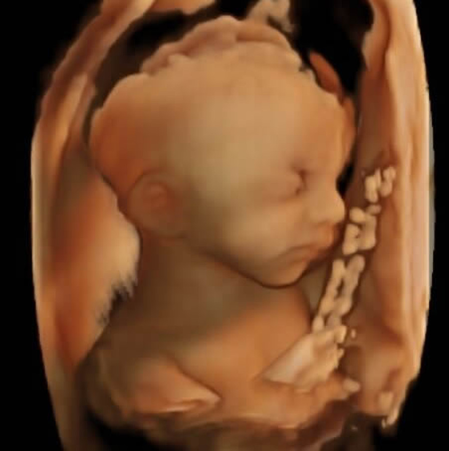 3D/4D Ultrasound for $99<br>Call 937.393.6266 to schedule
